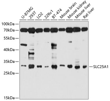 Western blot - SLC25A1 Polyclonal Antibody 
