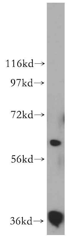 human heart tissue were subjected to SDS PAGE followed by western blot with Catalog No:114670(RDH14 antibody) at dilution of 1:200
