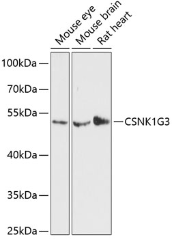 Western blot - CSNK1G3 Polyclonal Antibody 