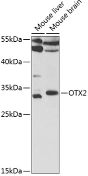 Western blot - OTX2 Polyclonal Antibody 