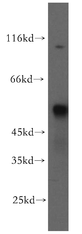 MCF7 cells were subjected to SDS PAGE followed by western blot with Catalog No:116439(TSP50 antibody) at dilution of 1:300