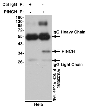 Immunoprecipitation analysis of Hela cell lysates using PINCH mouse mAb.