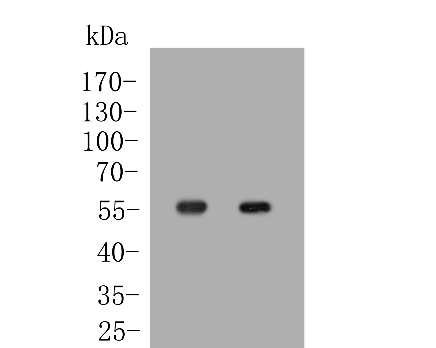 Fig1:; Western blot analysis of Perilipin-5 on different lysates. Proteins were transferred to a PVDF membrane and blocked with 5% BSA in PBS for 1 hour at room temperature. The primary antibody ( 1/500) was used in 5% BSA at room temperature for 2 hours. Goat Anti-Rabbit IgG - HRP Secondary Antibody (HA1001) at 1:5,000 dilution was used for 1 hour at room temperature.; Positive control:; Lane 1: Human liver tissue lysate; Lane 2: Human marrow tissue lysate
