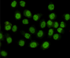 Immunocytochemistry staining of HeLa cells fixed with 4% Paraformaldehyde and using anti-SMC1A mouse mAb(dilution 1:100).