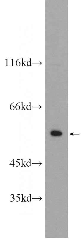 A431 cells were subjected to SDS PAGE followed by western blot with Catalog No:109712(CYP7B1 Antibody) at dilution of 1:1000