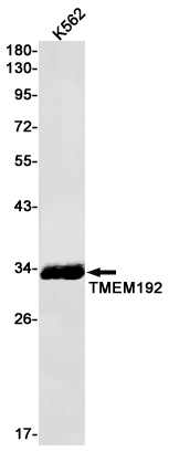 Western blot detection of TMEM192 in K562 cell lysates using TMEM192 Rabbit pAb(1:1000 diluted).Predicted band size:31kDa.Observed band size:31kDa.