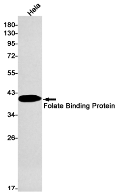 Western blot detection of Folate Binding Protein in Hela cell lysates using Folate Binding Protein Rabbit mAb(1:1000 diluted).Predicted band size:30kDa.Observed band size:40kDa.