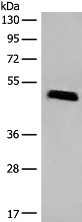Gel: 8%SDS-PAGE, Lysate: 40 μg, Lane: HEPG2 cell lysate, Primary antibody: 169082(IFNGR1 Antibody) at dilution 1/300, Secondary antibody: Goat anti rabbit IgG at 1/8000 dilution, Exposure time: 10 seconds