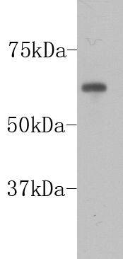 Fig1: Western blot analysis on F9 cell lysates using anti-PGBD5 Mouse mAb (Cat. # 176652#).