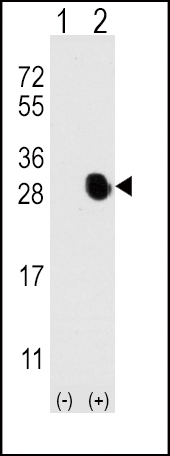 Western blot analysis of Osteocalcin (arrow) using rabbit polyclonal Osteocalcin Antibody (N-term) (Cat.#167511).293 cell lysates (2 ug/lane) either nontransfected (Lane 1) or transiently transfected with the BGLAP gene (Lane 2) (Origene Technologies).