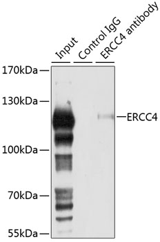Immunoprecipitation - ERCC4 Polyclonal Antibody 