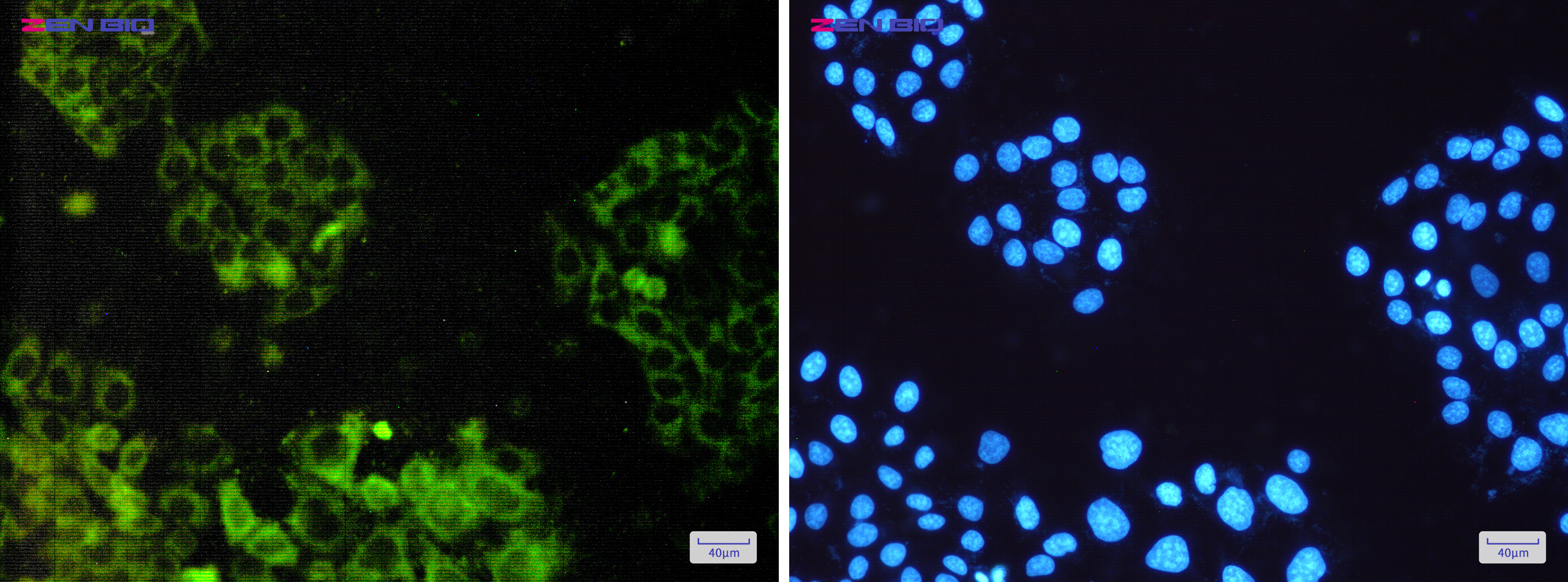 Immunocytochemistry of ATP6V1E1(green) in Hela cells using ATP6V1E1 Rabbit pAb at dilution 1/50, and DAPI(blue)