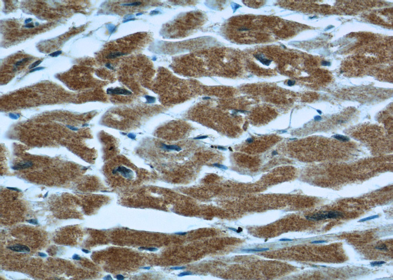 Immunohistochemical of paraffin-embedded human heart using Catalog No:116338(TRAP1 antibody) at dilution of 1:50 (under 40x lens)