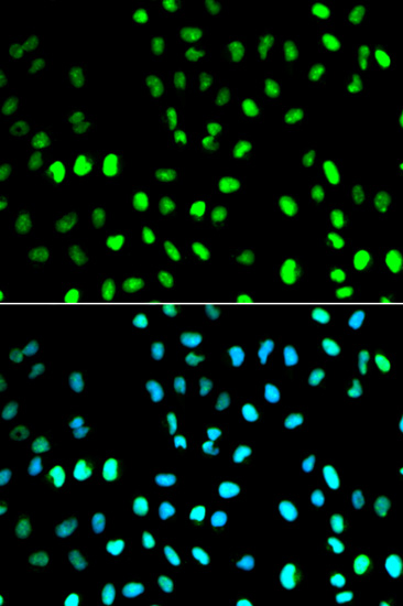 Immunofluorescence analysis of MCF7 cell using SUMO1 antibody. Blue: DAPI for nuclear staining.