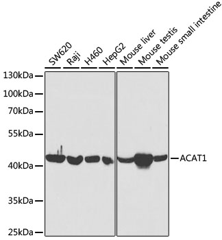 Western blot - ACAT1 Polyclonal Antibody 