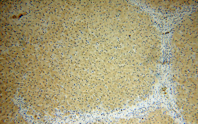 Immunohistochemical of paraffin-embedded human liver using Catalog No:109411(CLYBL antibody) at dilution of 1:50 (under 10x lens)