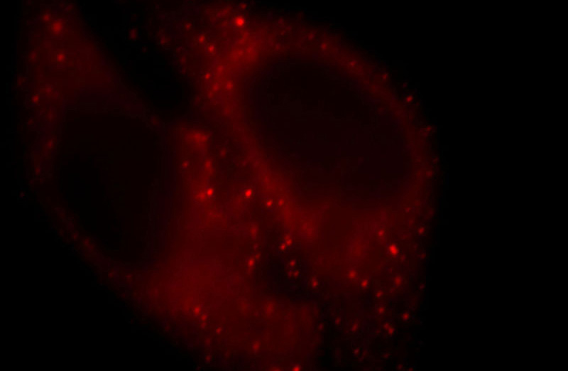 Immunofluorescent analysis of HepG2 cells, using ARF1 antibody Catalog No:108243 at 1:25 dilution and Rhodamine-labeled goat anti-rabbit IgG (red).