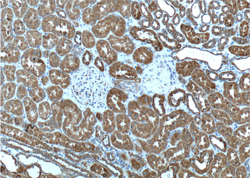 Immunohistochemistry of paraffin-embedded human kidney tissue slide using Catalog No:107619(TELO2 Antibody) at dilution of 1:200 (under 10x lens).
