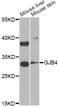 Western blot - GJB4 Polyclonal Antibody 