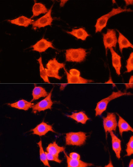 Immunofluorescence - SERPINA12 Polyclonal Antibody 
