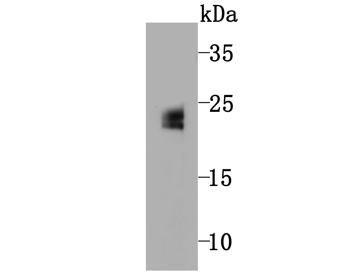 Fig2: Western blot analysis of GPX5 on mouse testis tissue lysate using anti-GPX5 antibody at 1/500 dilution.