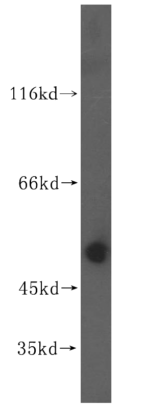 human brain tissue were subjected to SDS PAGE followed by western blot with Catalog No:117254(ZNHIT2 antibody) at dilution of 1:500