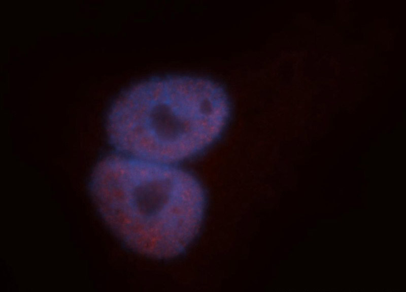Immunofluorescent analysis of A549 cells, using TARDBP antibody Catalog No:115926 at 1:50 dilution and Rhodamine-labeled goat anti-rabbit IgG (red). Blue pseudocolor = DAPI (fluorescent DNA dye).