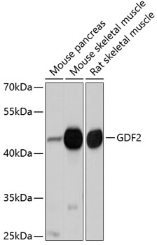 Western blot - GDF2 Polyclonal Antibody 