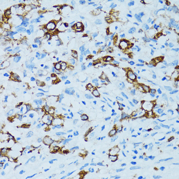 Immunohistochemistry - CTSE Polyclonal Antibody 