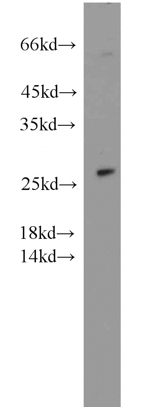DU 145 cells were subjected to SDS PAGE followed by western blot with Catalog No:115539(SPANXA2 antibody) at dilution of 1:500