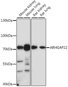 Western blot - ARHGAP22 Polyclonal Antibody 