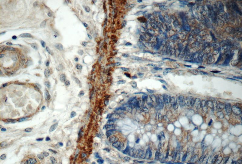 Immunohistochemistry of paraffin-embedded human colon tissue slide using Catalog No:112831(MRPL47 Antibody) at dilution of 1:50 (under 40x lens)