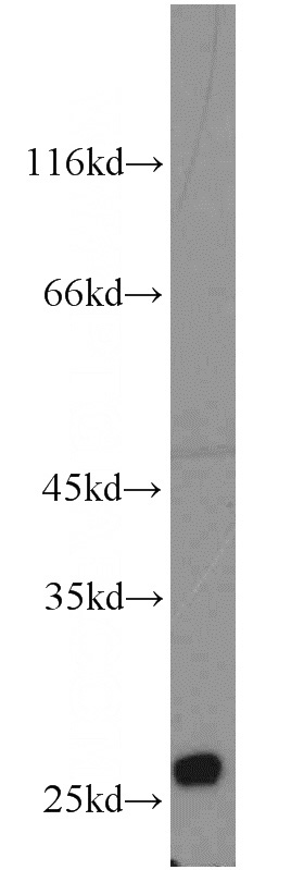 PC-3 cells were subjected to SDS PAGE followed by western blot with Catalog No:109450(Connexin-26 antibody) at dilution of 1:500