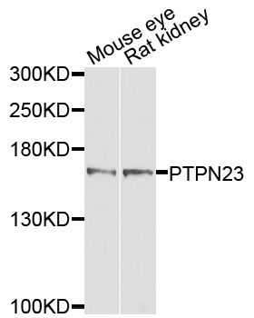 Western blot - PTPN23 Polyclonal Antibody 