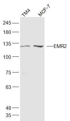 Fig1: Sample:; TM4(Mouse) Cell Lysate at 30 ug; MCF-7(Human) Cell Lysate at 30 ug; Primary: Anti-EMR2 at 1/300 dilution; Secondary: IRDye800CW Goat Anti-Rabbit IgG at 1/20000 dilution; Predicted band size: 88 kD; Observed band size: 128 kD