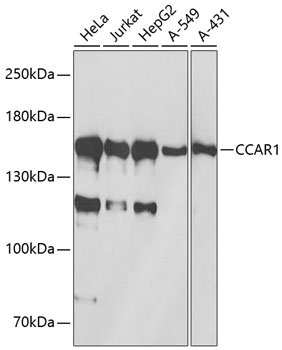 Western blot - CCAR1 Polyclonal Antibody 
