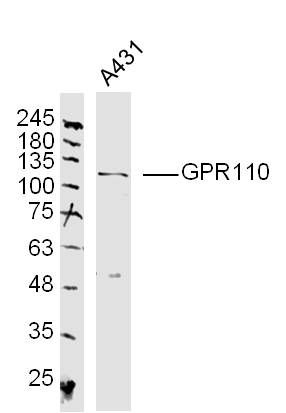Fig2: Sample: A431 (human)Cell Lysate at 40 ug; Primary: Anti-GPR110 at 1/300 dilution; Secondary: IRDye800CW Goat Anti-Rabbit IgG at 1/20000 dilution; Predicted band size: 99 kD; Observed band size: 109 kD