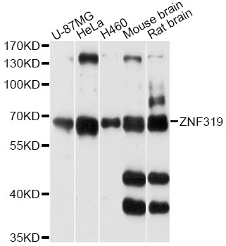 Western blot - ZNF319 Polyclonal Antibody 