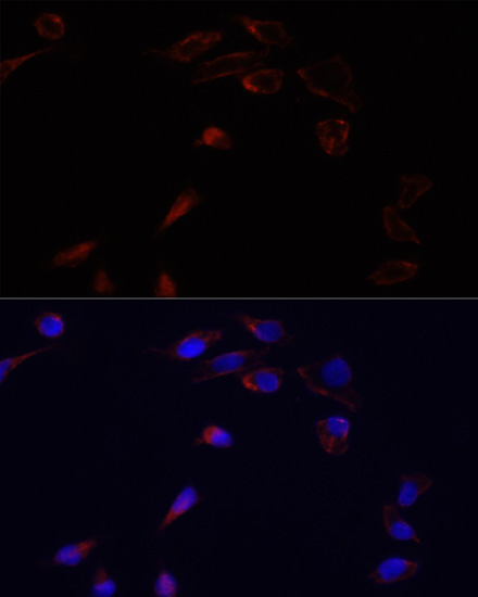 Immunofluorescence - ADRA1B Polyclonal Antibody 