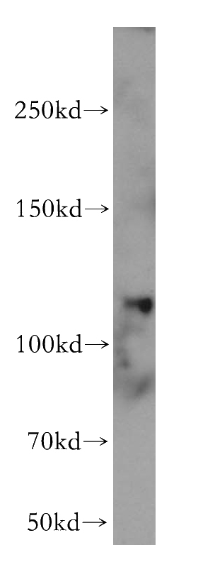 K-562 cells were subjected to SDS PAGE followed by western blot with Catalog No:110191(EIF3C antibody) at dilution of 1:500