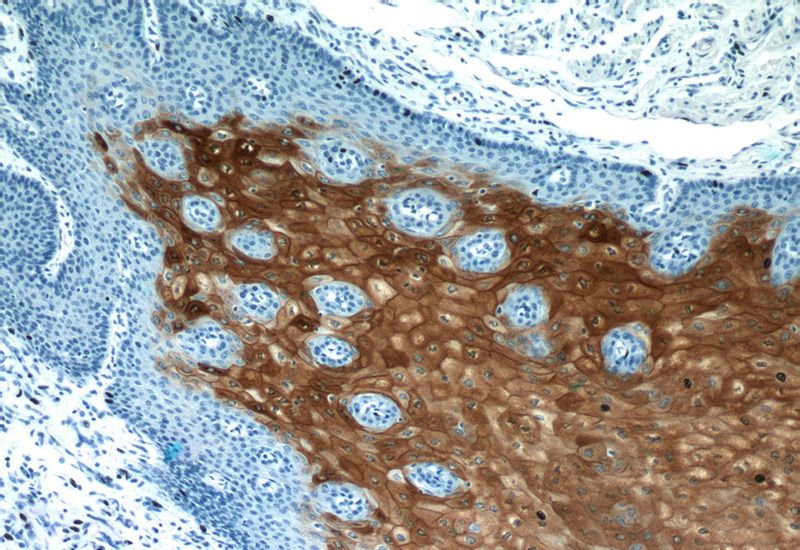Immunohistochemistry of paraffin-embedded human oesophagus tissue slide using Catalog No:109575(CRNN Antibody) at dilution of 1:200 (under 10x lens). Heat mediated antigen retrieved with Citric acid buffer, pH6.0
