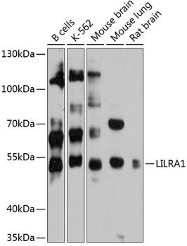 Western blot - LILRA1 Polyclonal Antibody 