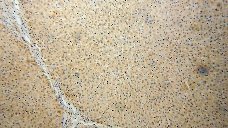 Immunohistochemical of paraffin-embedded human liver using Catalog No:113564(PALMD antibody) at dilution of 1:100 (under 10x lens)