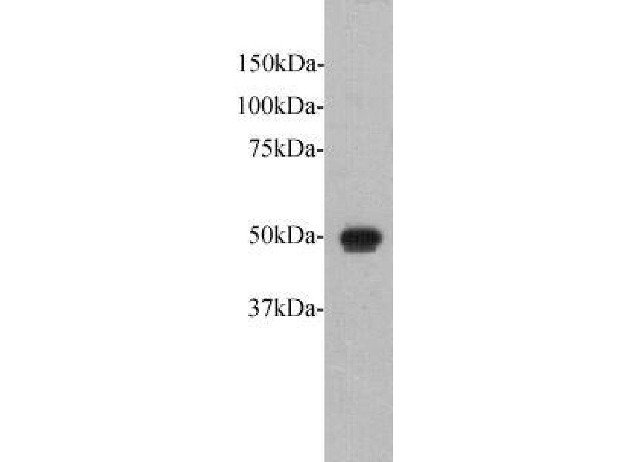 Fig1:; Western blot analysis on Fat1 recombinant protein at 1:5,000.
