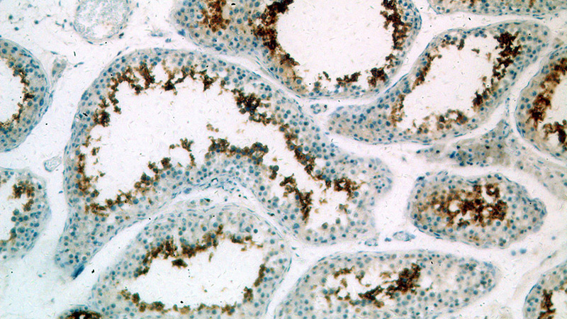 Immunohistochemical of paraffin-embedded human testis using Catalog No:111024(GLIPR1L1 antibody) at dilution of 1:100 (under 10x lens)