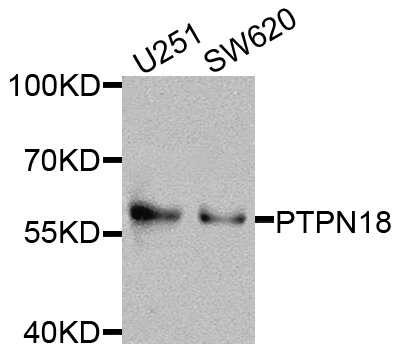 Western blot - PTPN18 Polyclonal Antibody 
