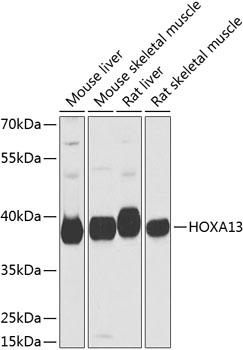Western blot - HOXA13 Polyclonal Antibody 