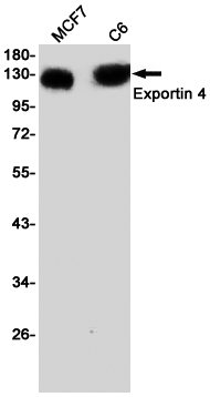 Western blot detection of Exportin 4 in MCF7,C6 cell lysates using Exportin 4 Rabbit pAb(1:1000 diluted).Predicted band size:130KDa.Observed band size:130KDa.