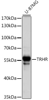 Western blot - TRHR Polyclonal Antibody 