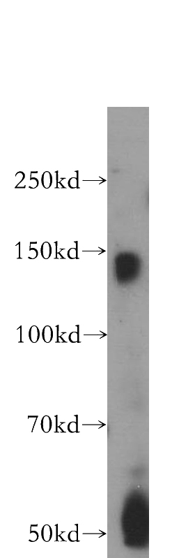 human heart tissue were subjected to SDS PAGE followed by western blot with Catalog No:117204(BMPR2 antibody) at dilution of 1:400